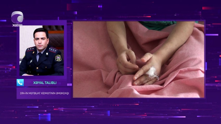 xacmazda-anasi-terefinden-doyulen-7-yasli-qiz-usaginin-veziyyeti-necedir-videonbsp-1726034024